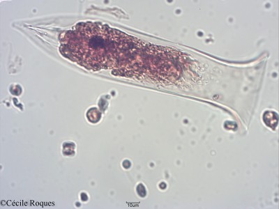 protozoo/Amphorides sp. (1)(copy)_thumb.jpg
